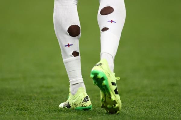 Holes cut into the socks of Bukayo Saka during an England Euro 2024 warm-up game