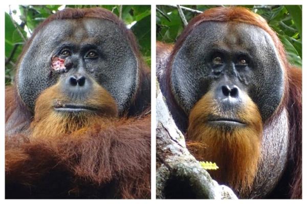 This combination of photos provided by the Suaq foundation shows a facial wound on Rakus, a wild male Sumatran orangutan in Gunung Leuser Natio<em></em>nal Park