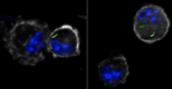 Remodeling the immune system to fight tuberculosis