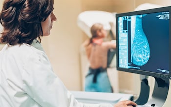 Breast cancer is the most commo<em></em>nly diagnosed cancer in the UK
