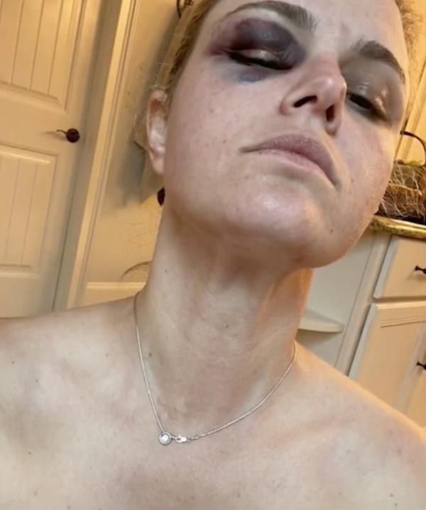 The masked man viscously beat her with the butt of a pistol and would go on to restrain the mother of two with zip ties and sexually assault her.