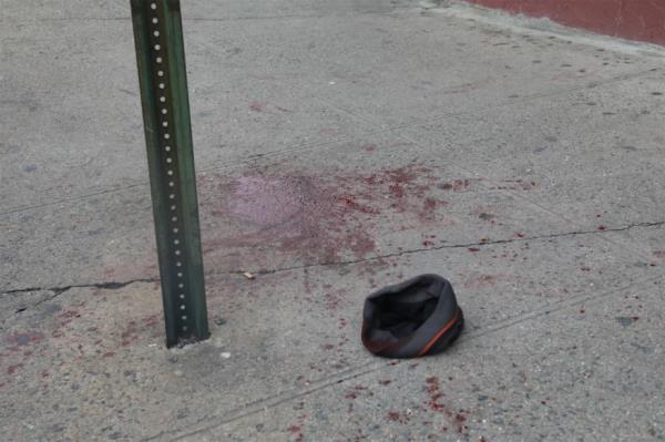 Bronx stabbing