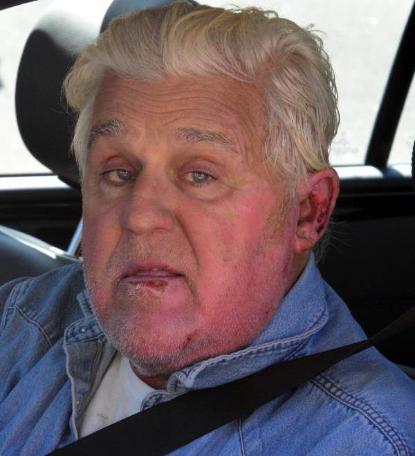 Jay Leno seems to be on the mend with obvious burn signs as is spotted arriving at his car garage in Burbank, Ca.</p>

<p>　　